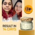 Before and after results using Youth Face Beauty Cream