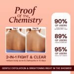 DarkSpot Remover Soap before and after skin improvement results