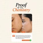 Papaya Face Scrub for blackheads and whiteheads