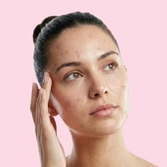 youth face cream for Pimple Marks