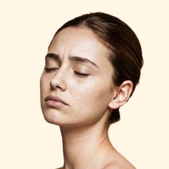 youth face skin concern06
